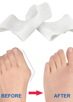 Orthèse orteil souple et discrète pour Hallux Valgus Sumifun Healthy Store