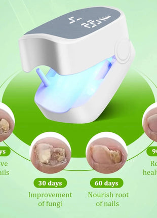 Loftat™ FungaRay Stone's Store